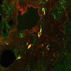 Figure from: Steiner AA et al. PLoS Biol 4: e284, 2006